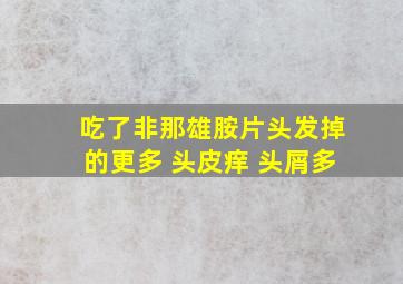 吃了非那雄胺片头发掉的更多 头皮痒 头屑多